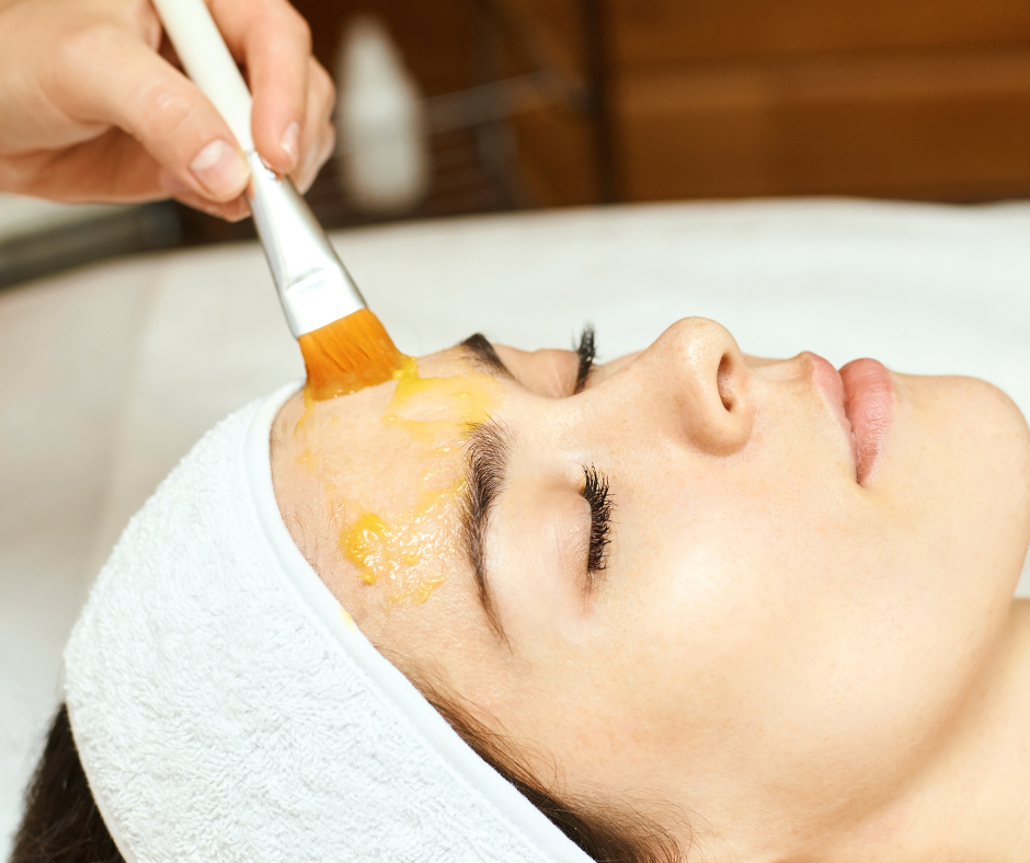 Chemical Peel