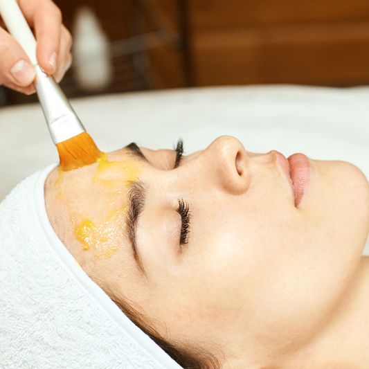 Chemical Peel