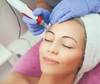 Mesotherapy with Microneedling